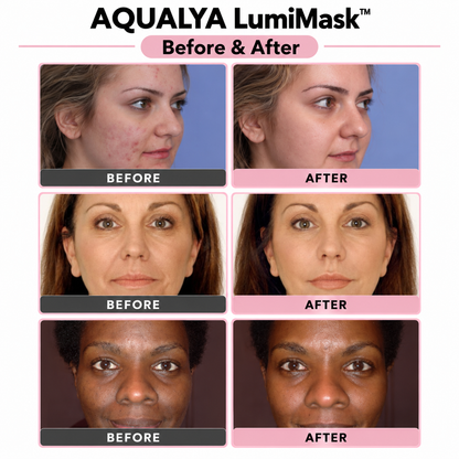 AQUALYA LumiMask™ LED – Spa-Worthy Skin in 15 Minutes + Medicube Firming Cream