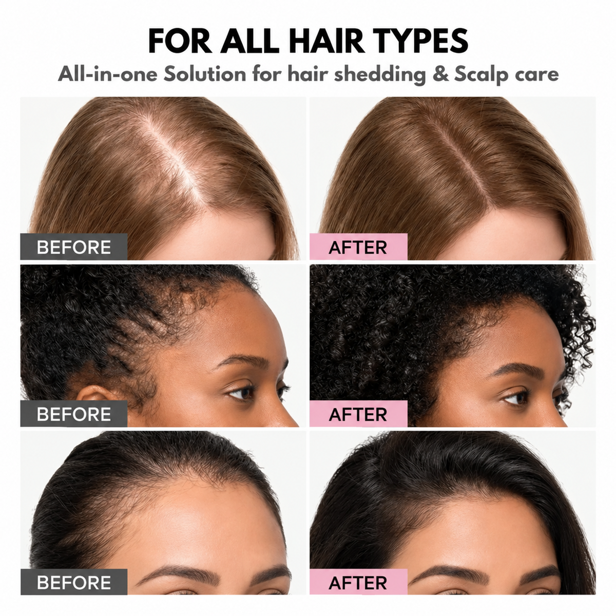 AQUALYA Korean Hair Serum – Stronger-Looking Hair from the Roots